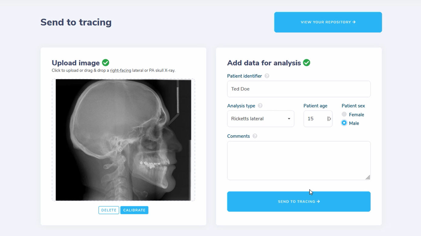 Wedoceph help - Tracing example – a case study